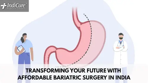 Informational graphic promoting affordable bariatric surgery in India, featuring a stomach diagram and healthcare providers.